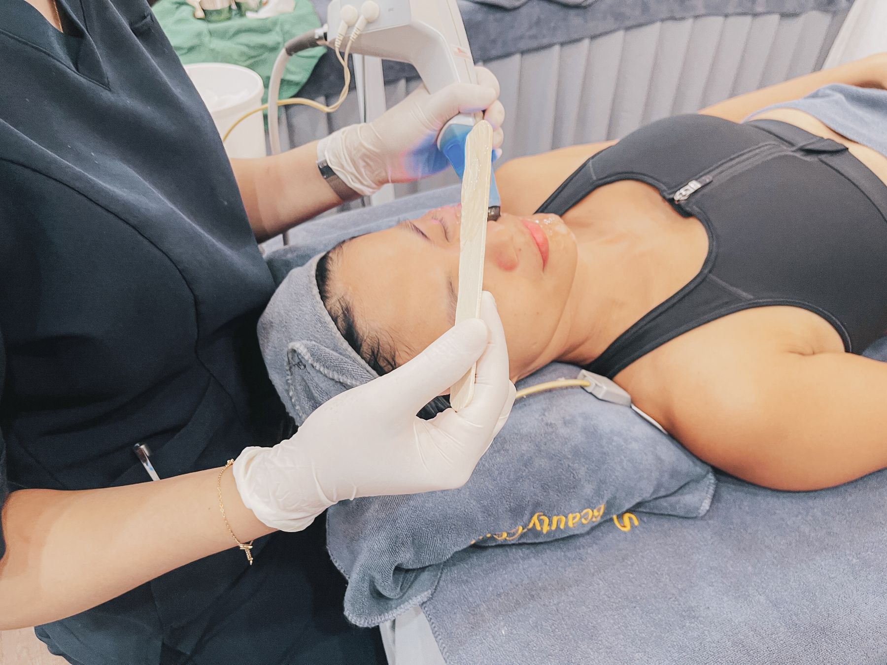 Quy trình điều trị Exilis tại Alma Clinic