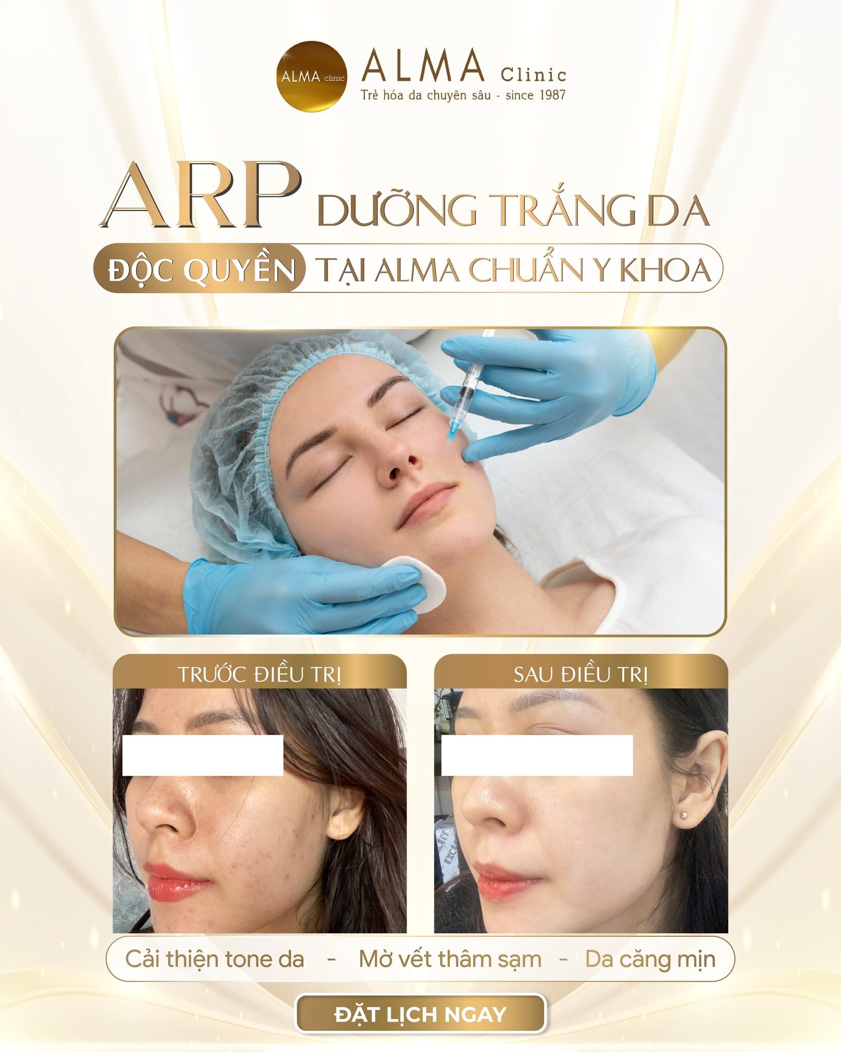 arp doc quyen duong trang da chuan y khoa tai alma Dưỡng sáng da cùng ARP