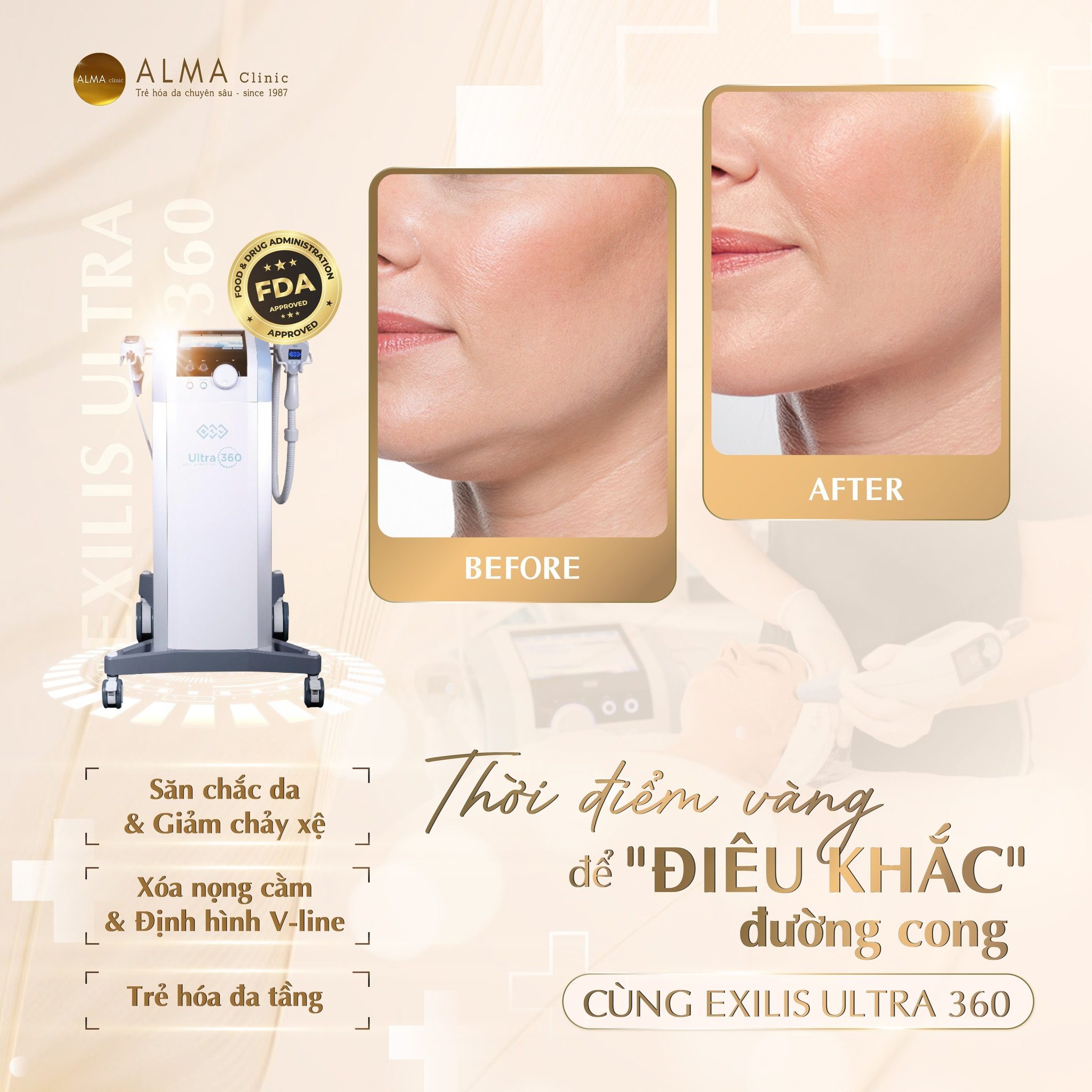 elixis ultra 360 ba truoc sau va cong dung Kết quả điều trị săn chắc da Exilis Ultra 360