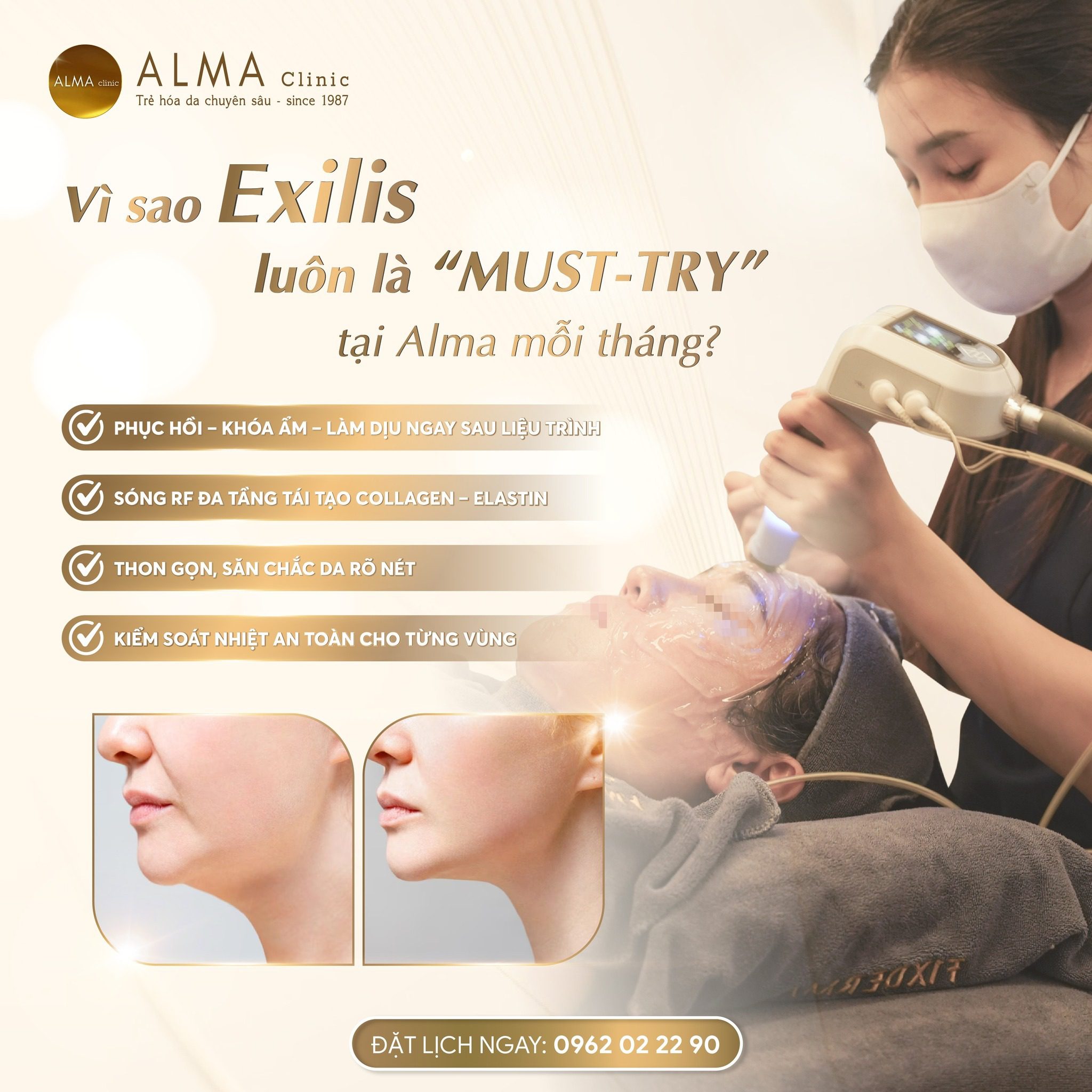 elixis vi sao must try Vì sao nên chọn công nghệ Exilis Ultra 360