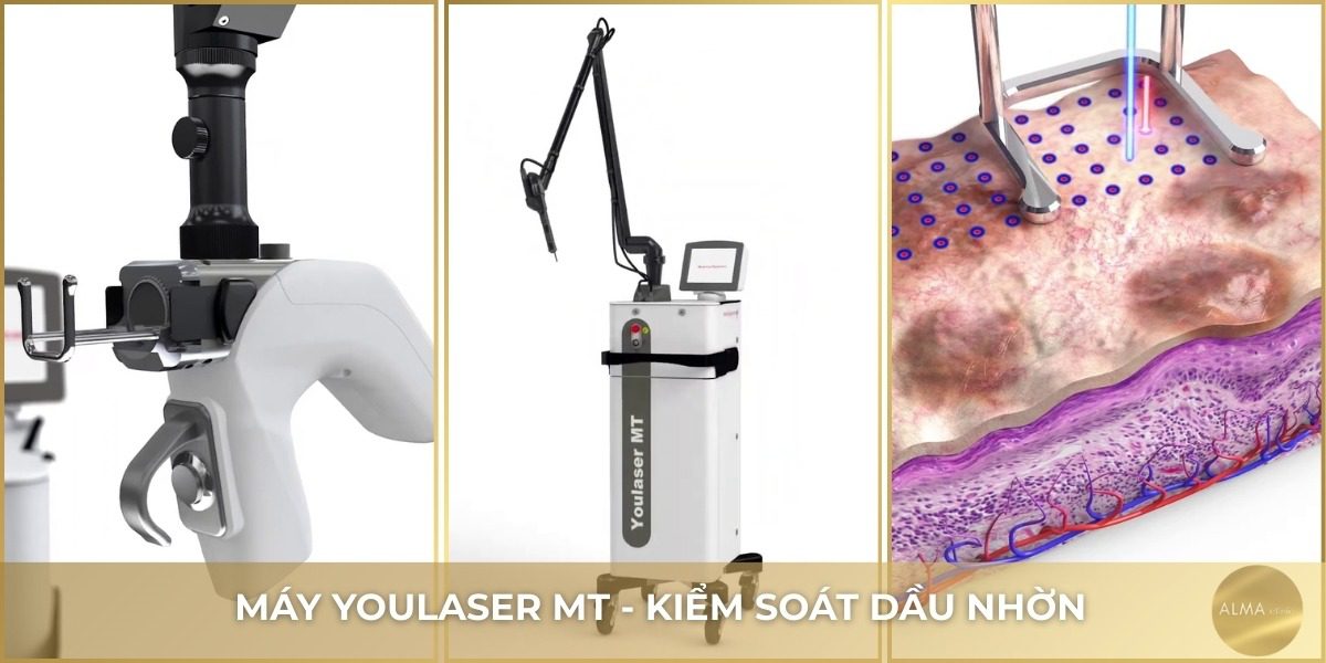 Giải pháp công nghệ cao máy Youlaser MT