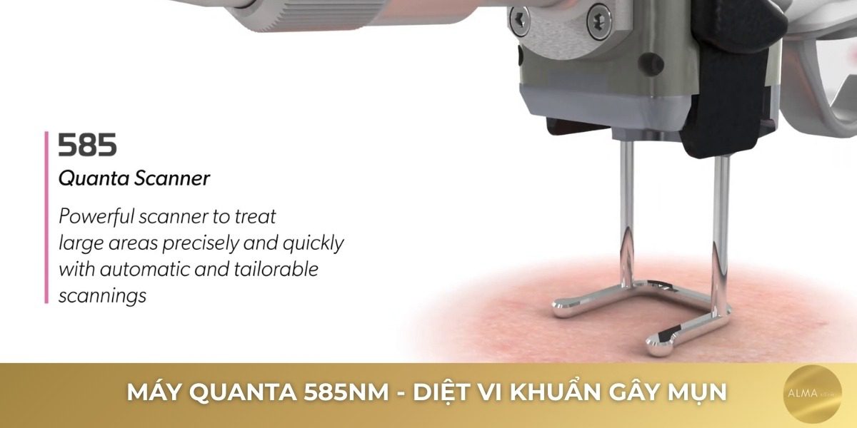 Thông số kỹ thuật Quanta 585