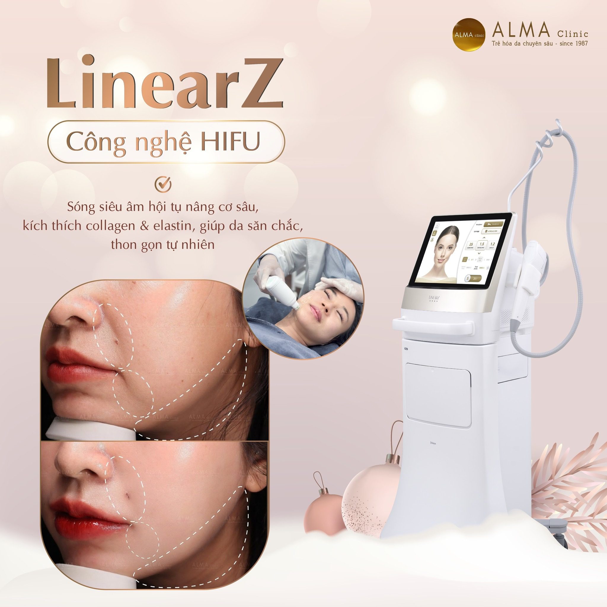 Hifu Linear Z là sóng siêu âm hội tụ nâng cơ sâu, kích thích collagen và elastin, giúp da săn chắc, thon gọn tự nhiên.