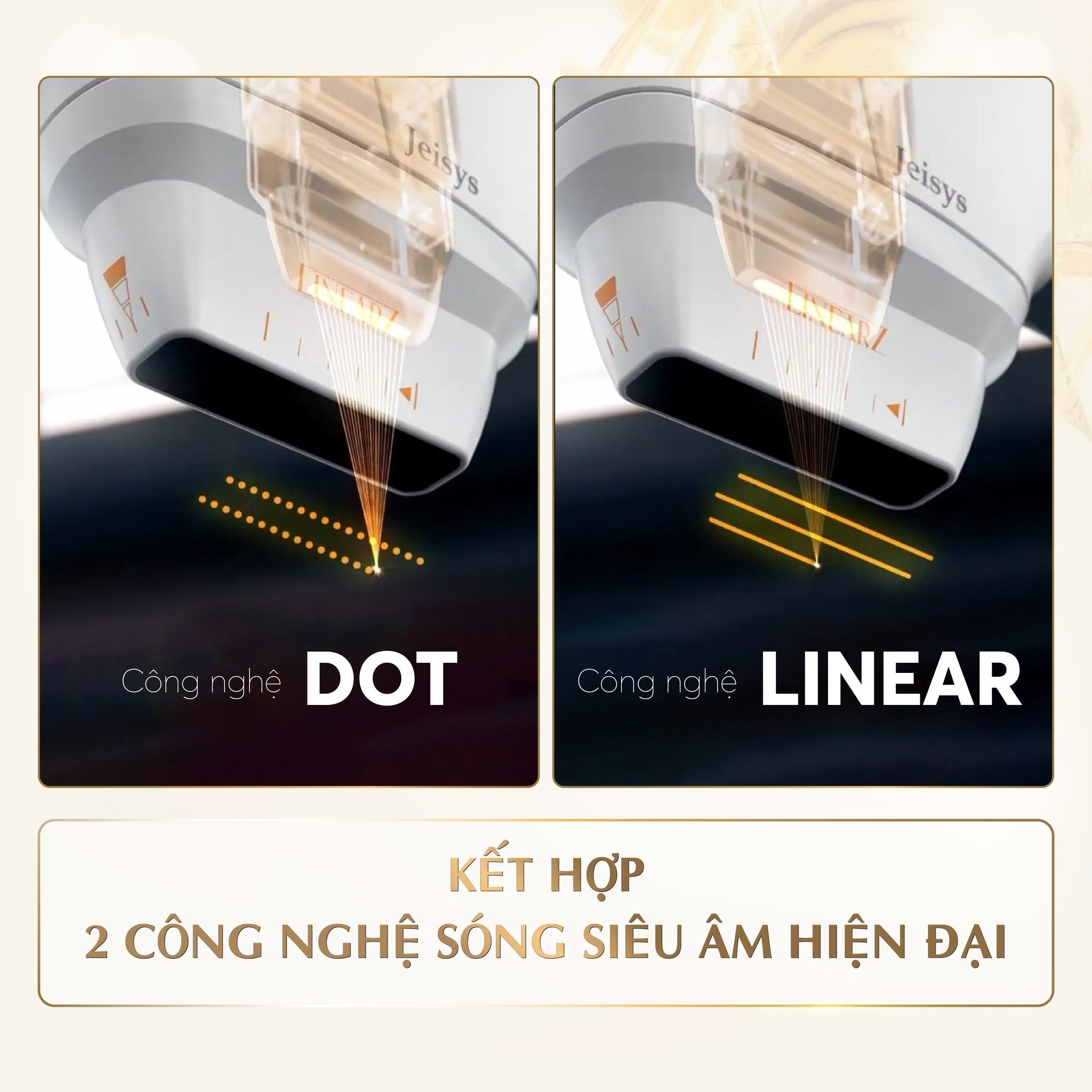 Công nghệ sóng âm hiện đại HIFU Linear Z