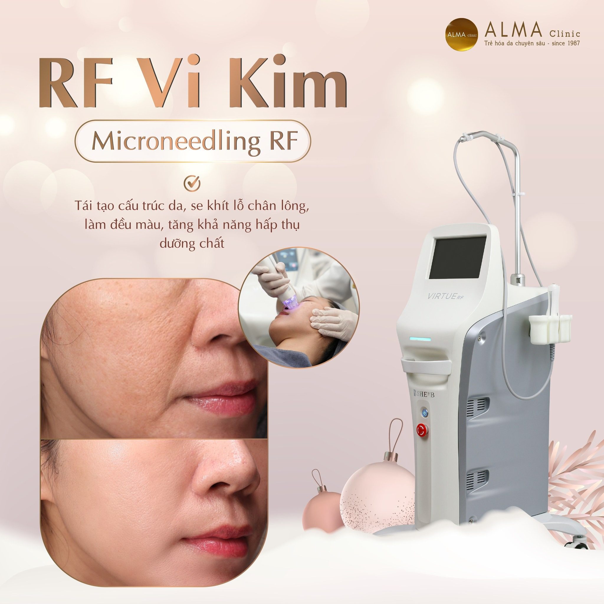 Virtue RF - Hệ thống vi kim công dụng tái tạo da